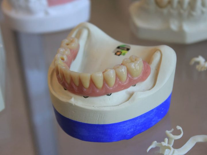 viladent-laboratorio-protese-dental- (3) viladent-laboratorio-protese-dental- (3)