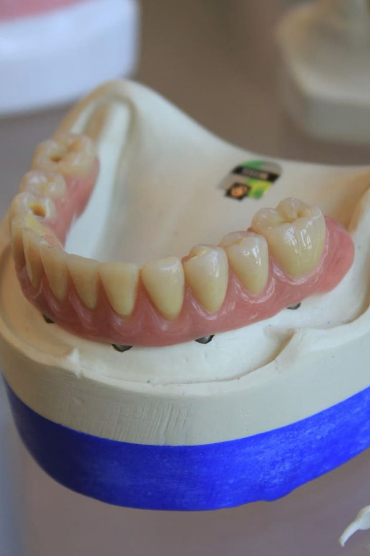 viladent-laboratorio-protese-dental- (3) viladent-laboratorio-protese-dental- (3)
