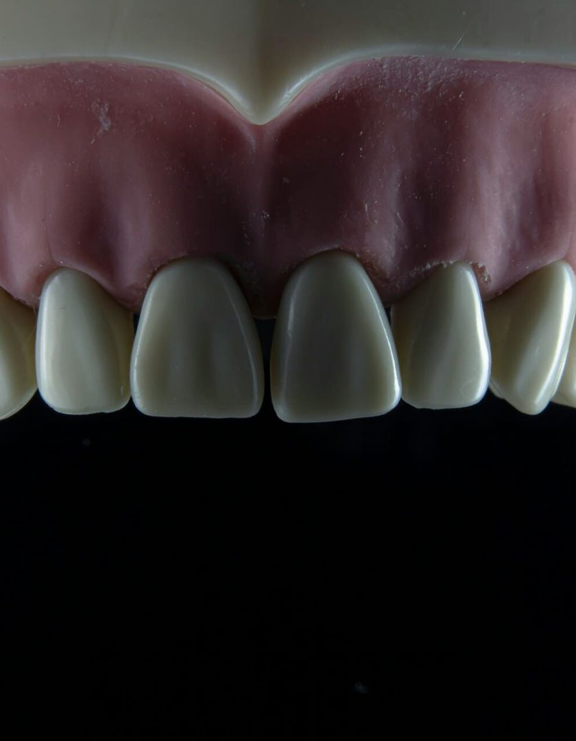 viladent-laboratorio-protese-dental- (5) viladent-laboratorio-protese-dental- (5)