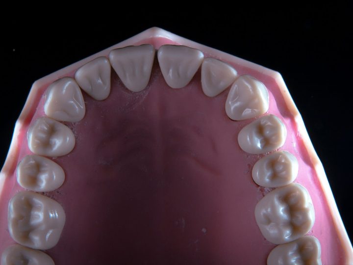viladent-laboratorio-protese-dental- (6) viladent-laboratorio-protese-dental- (6)