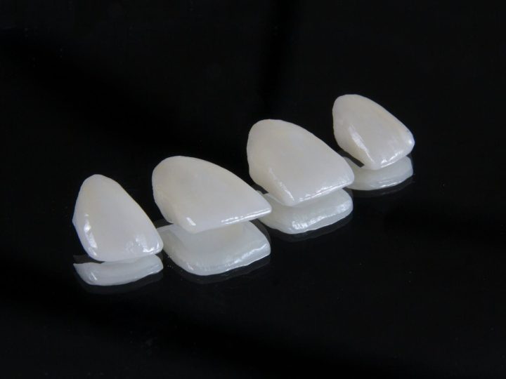 viladent-laboratorio-protese-dental- (7) viladent-laboratorio-protese-dental- (7)